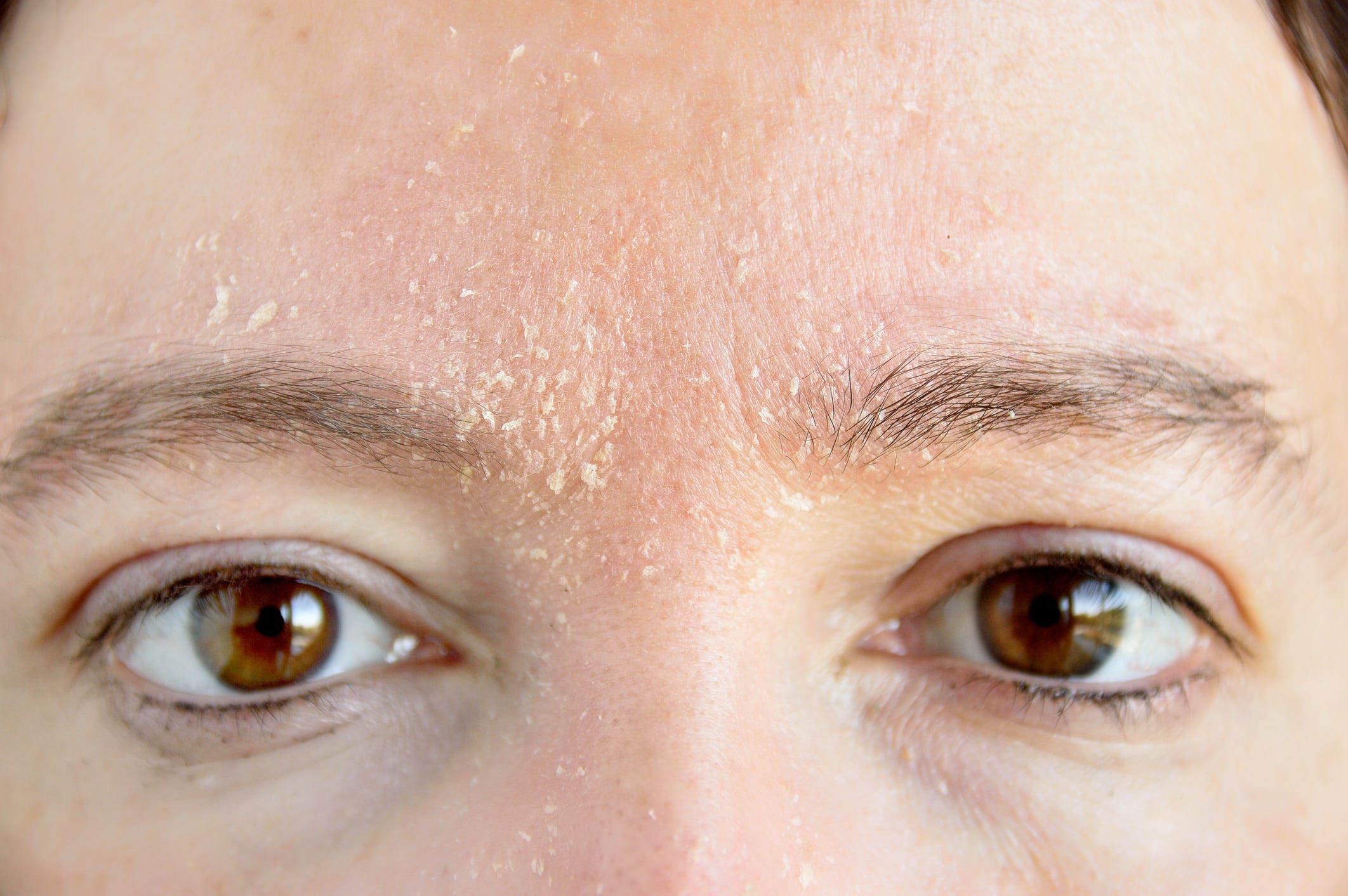 what causes dry skin on face